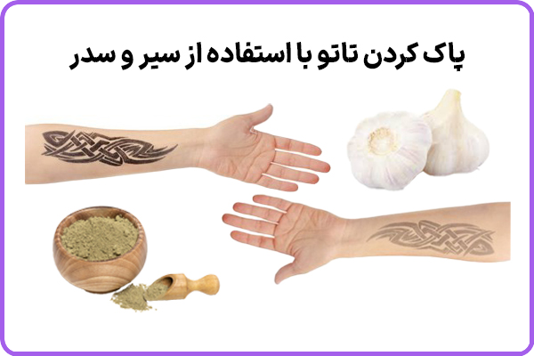 از بین بردن تاتو با استفاده از سیر
