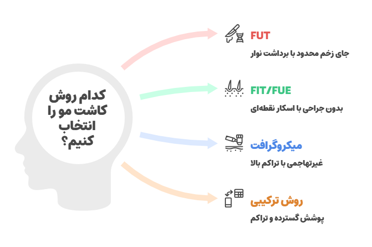 روش های کاشت مو