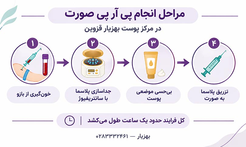 مراحل انجام پی آر پی صورت